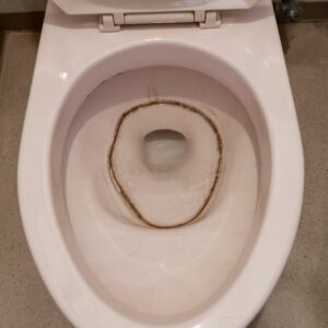 黒ずみを綺麗にしたい